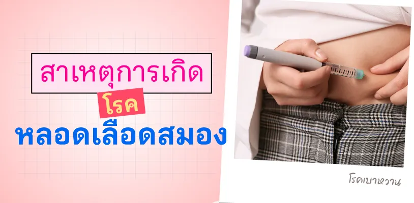 สาเหตุการเกิดโรคหลอดเลือดสมอง