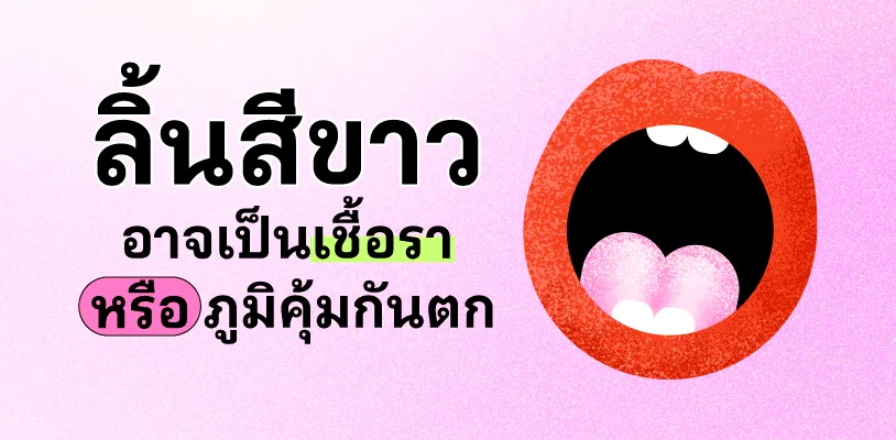 ลิ้นสีขาว อาจเป็นเชื้อราหรือภูมิคุ้มกันตก