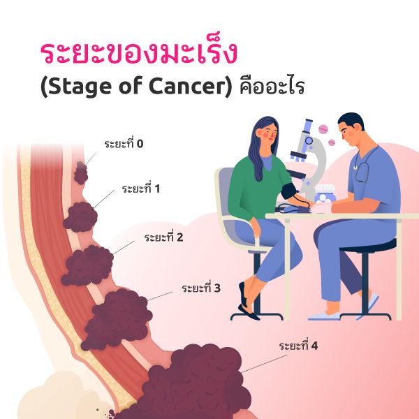 โรคมะเร็ง ระยะเริ่มต้น ระยะลุกลาม