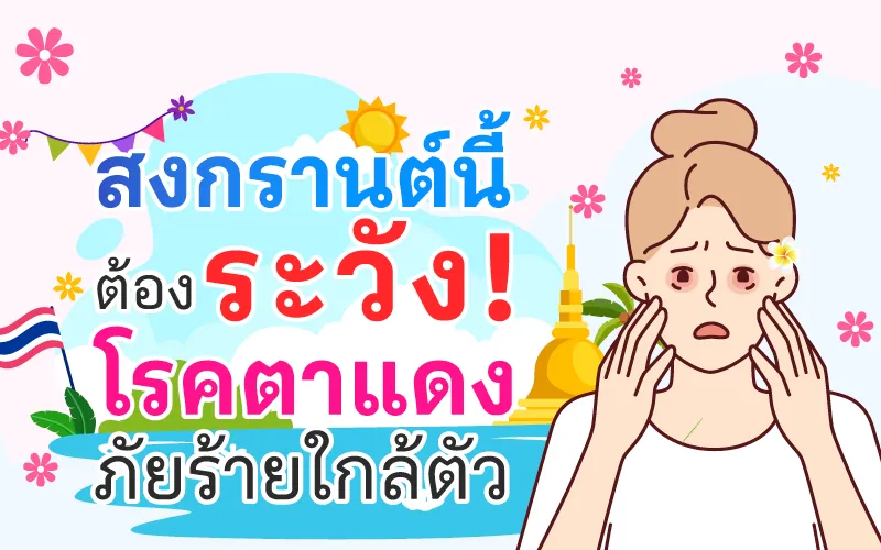 สงกรานต์นี้ต้องระวัง! โรคตาแดงภัยร้ายใกล้ตัว
