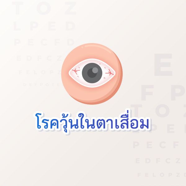 Eyes  Blog 2