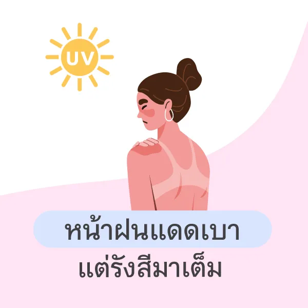 หน้าฝนจำเป็นต้องทาครีมกันแดดอยู่หรือไม่ Blog1