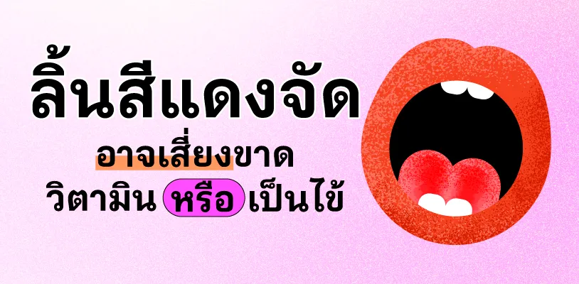 ลิ้นสีแดงจัด อาจเสี่ยงขาดวิตามิน หรือเป็นไข้