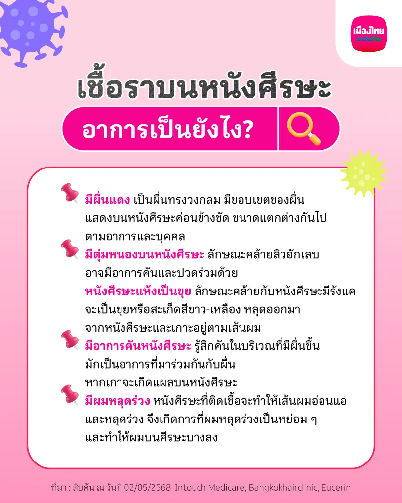 เชื้อราบนหนังศีรษะ อาการเป็นยังไง?