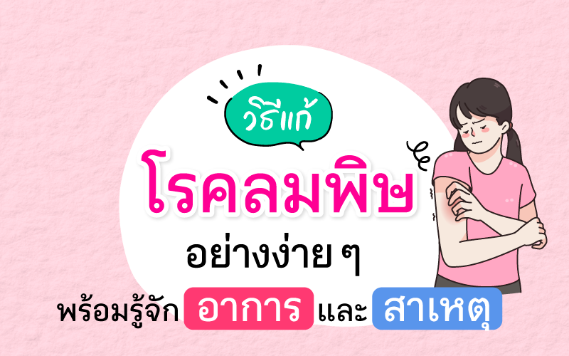 วิธีแก้โรคลมพิษอย่างง่าย ๆ พร้อมรู้จักอาการและสาเหตุ