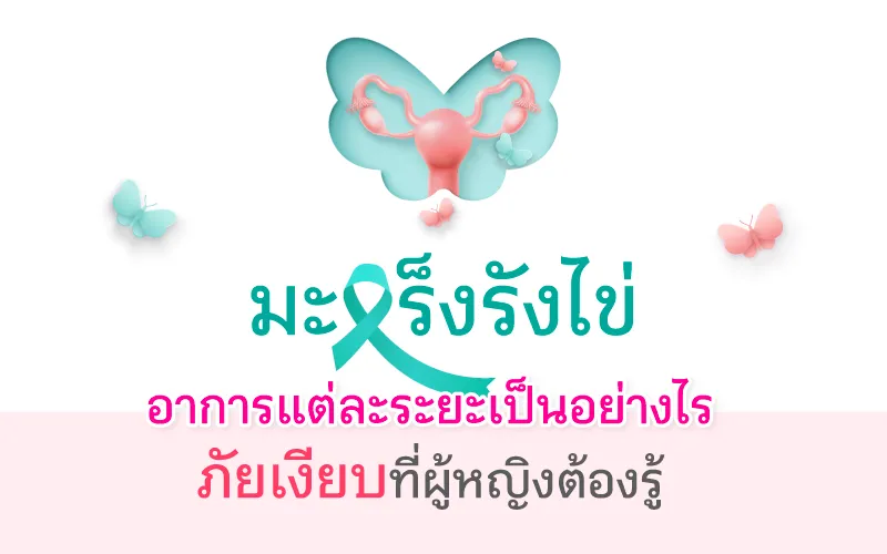 มะเร็งรังไข่ อาการแต่ละระยะเป็นอย่างไร ภัยเงียบที่ผู้หญิงต้องรู้