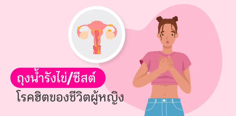 Ovarian cysts – common disease in women