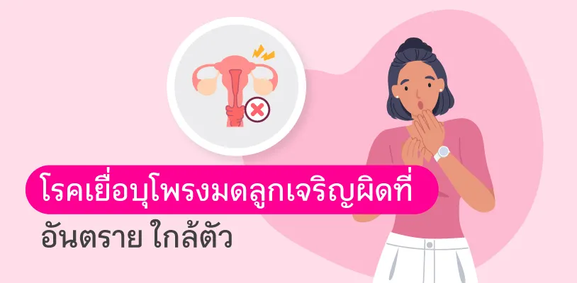 Endometriosis 