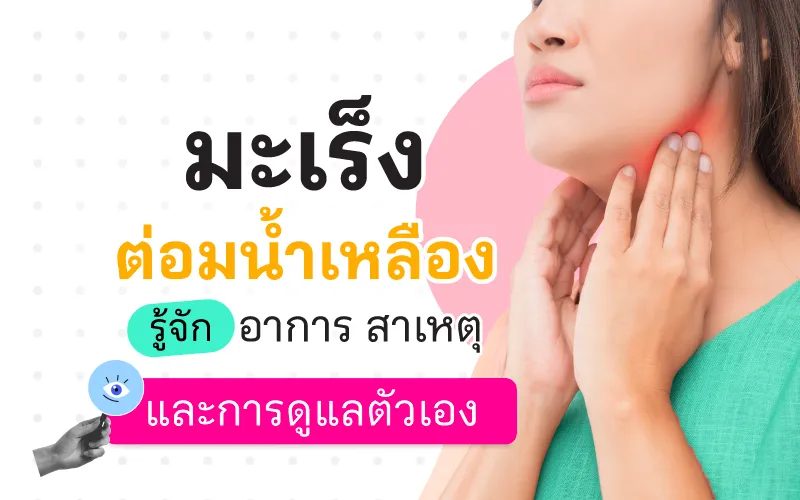 มะเร็งต่อมน้ำเหลือง รู้จัก อาการ สาเหตุ และการดูแลตัวเอง