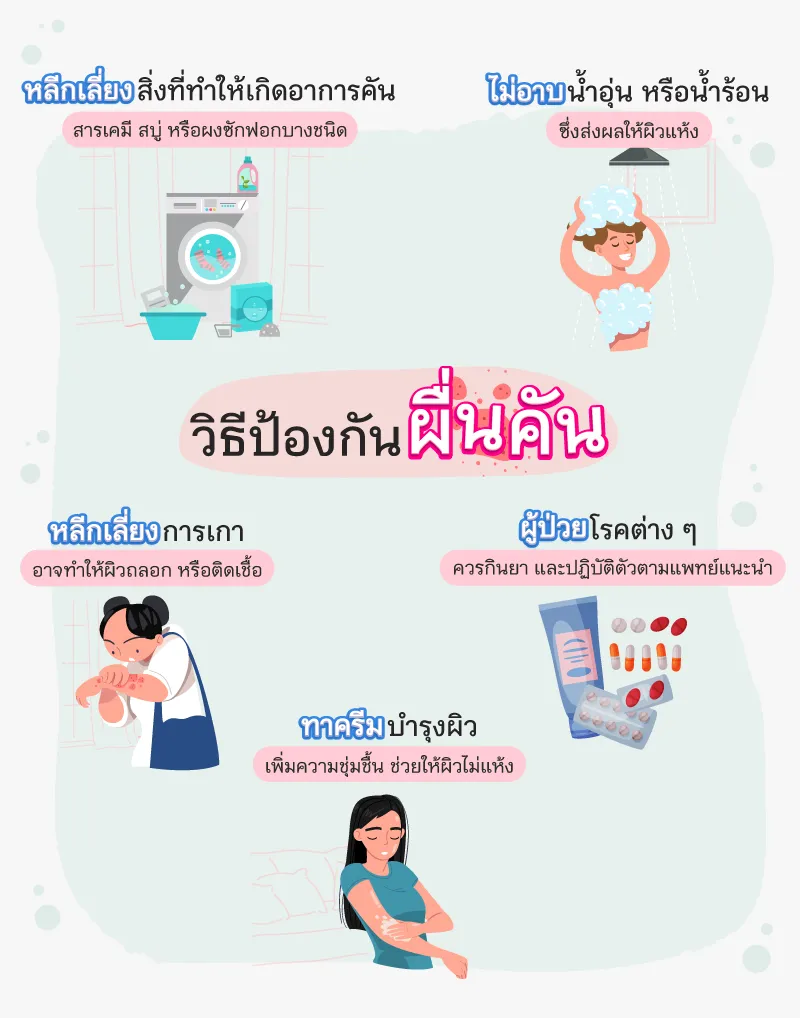 How to prevent itchy rash