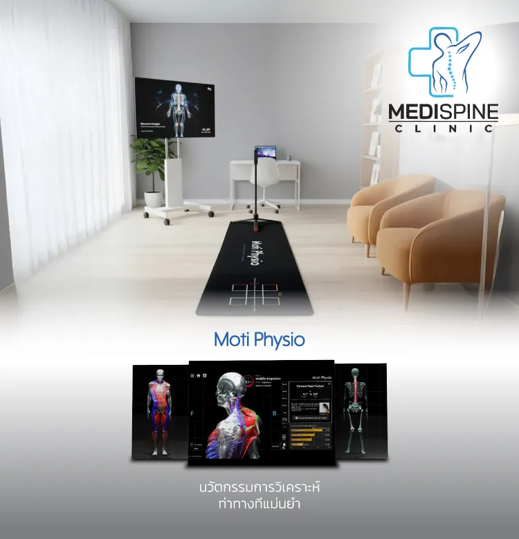 Medispine 750x780 Px