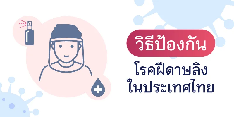 วิธีป้องกันโรคฝีดาษลิง ในประเทศไทย