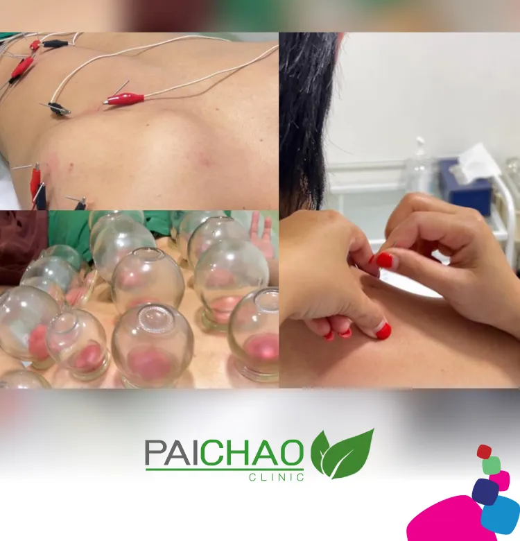 Paichao 750x780 Px