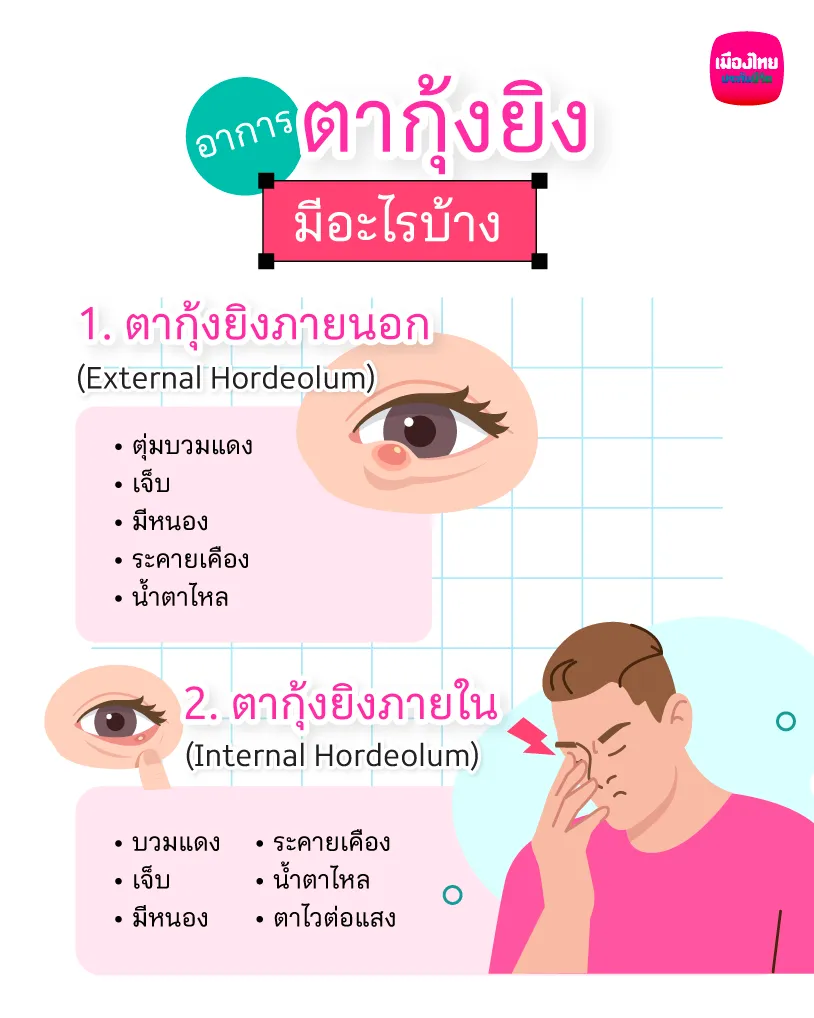 อาการตากุ้งยิง