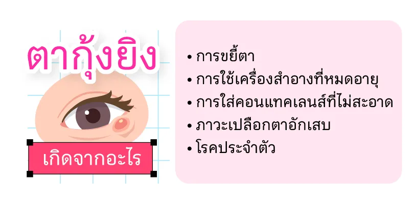 สาเหตุของตากุ้งยิง
