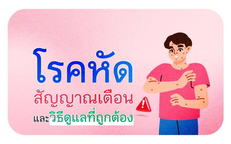 โรคหัด สัญญาณเตือนและวิธีดูแลที่ถูกต้อง