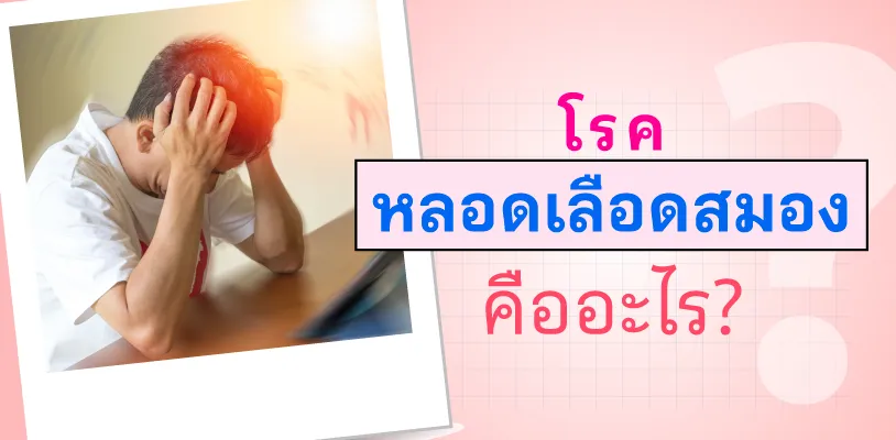  โรคหลอดเลือดสมองคืออะไร? 