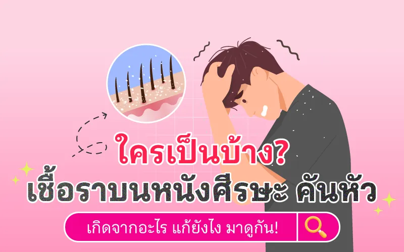 Temp เชื้อราบนหนังศีรษะ