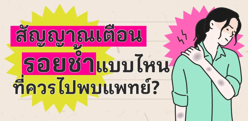 5. สัญญาณเตือน รอยช้ำแบบไหนที่ควรไปพบแพทย์?