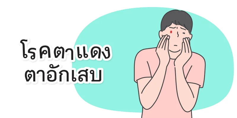 Pink Eye, Eye Inflammation