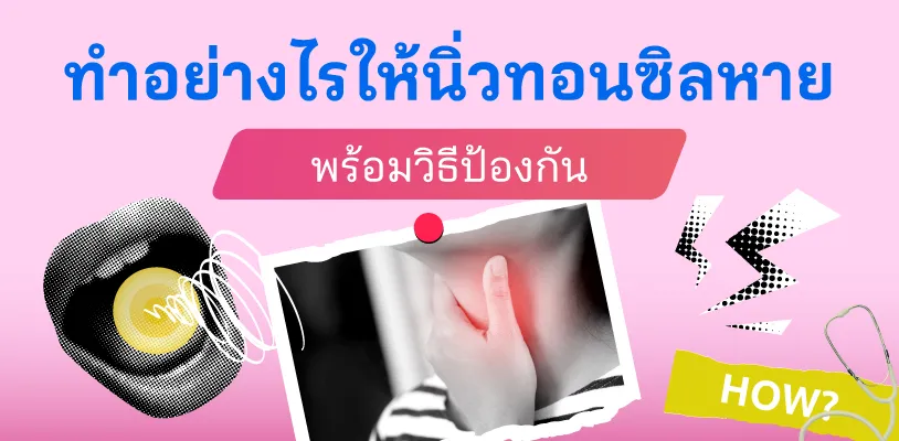 ทําอย่างไรให้นิ่วทอนซิลหาย พร้อมวิธีป้องกัน