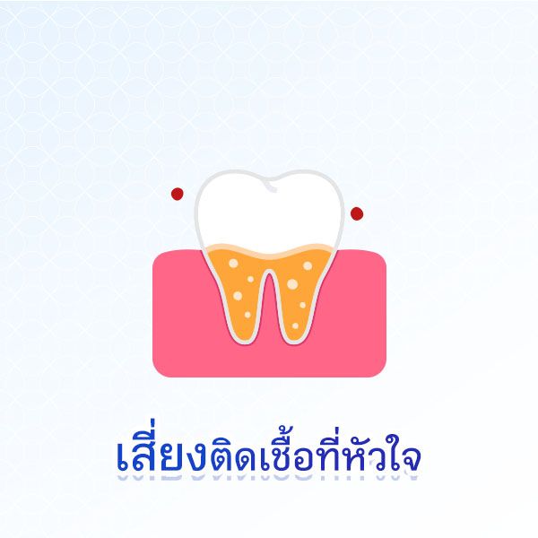 Decayedteeth  Blog 2