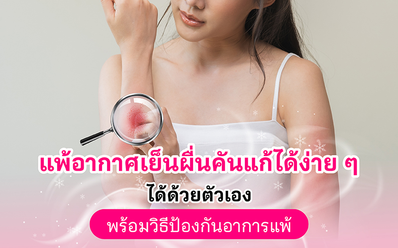 แพ้อากาศเย็นผื่นคันแก้ได้ง่าย ๆ ได้ด้วยตัวเอง พร้อมวิธีป้องกันอาการแพ้