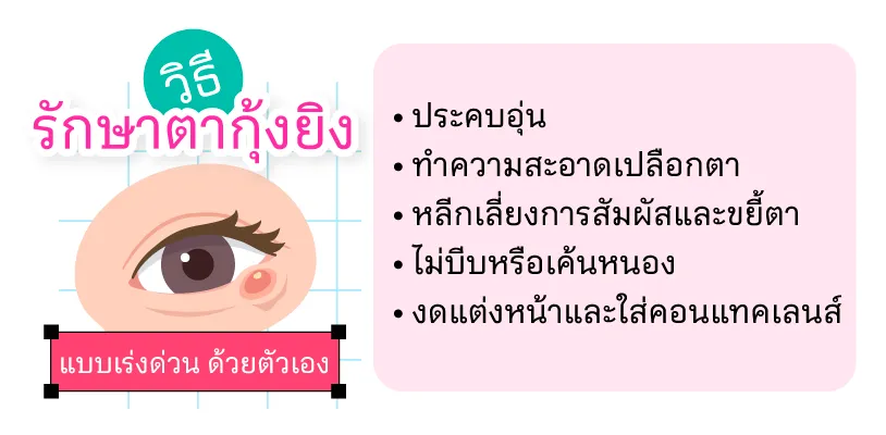  วิธีรักษาตากุ้งยิง แบบเร่งด่วน 