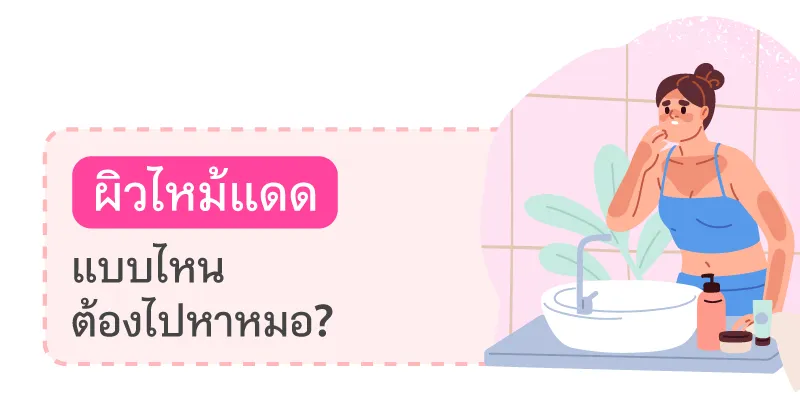 Blog ผิวไหม้แดดแบบไหนต้องหาหมอ 800x400