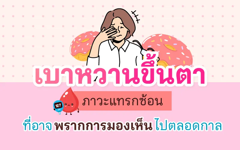 เบาหวานขึ้นตา ภาวะแทรกซ้อนที่อาจพรากการมองเห็นไปตลอดกาล