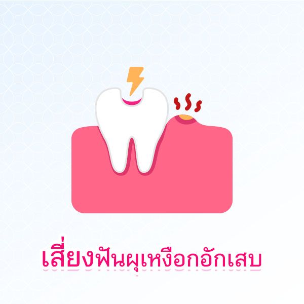 Decayedteeth  Blog 1