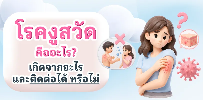 &nbsp;โรคงูสวัดคืออะไร? เกิดจากอะไร และติดต่อได้ หรือไม่
