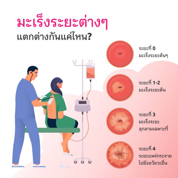 โรคมะเร็ง ระยะต่าง ๆ ระยะเริ่มต้น ระยะลุกลาม
