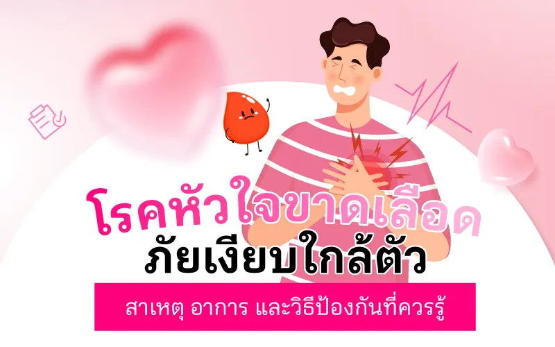 โรคหัวใจขาดเลือด ภัยเงียบใกล้ตัว สาเหตุ อาการ และวิธีป้องกันที่ควรรู้