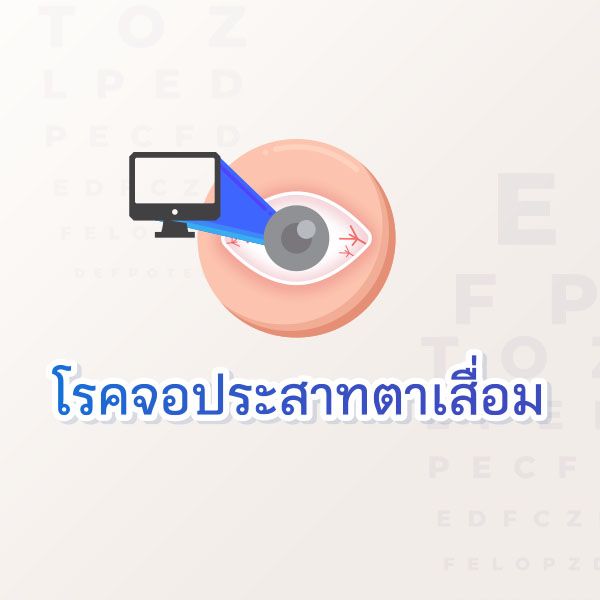 Eyes  Blog 4