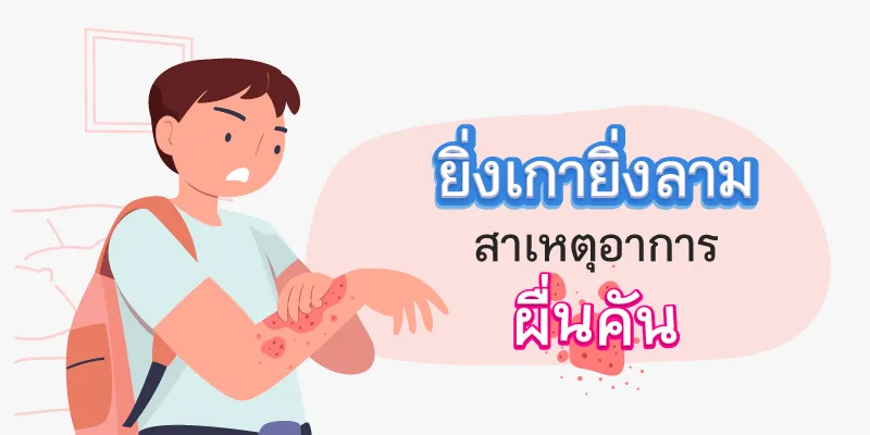 Causes of itchy rash