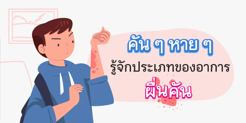 Symptoms of itchy rash