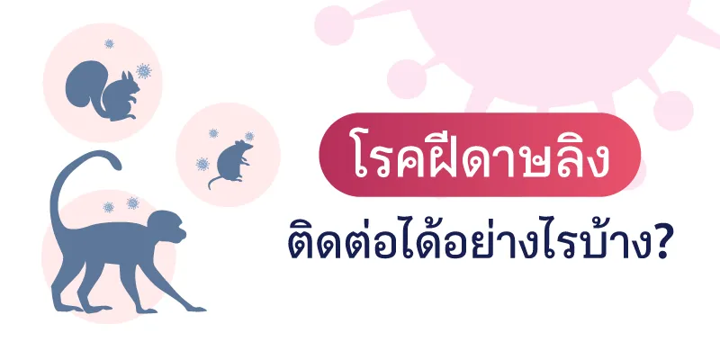 โรคฝีดาษลิง ติดต่อได้อย่างไรบ้าง?