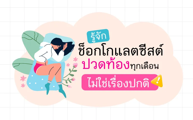 รู้จักช็อกโกแลตซีสต์ ปวดท้องทุกเดือน ไม่ใช่เรื่องปกติ