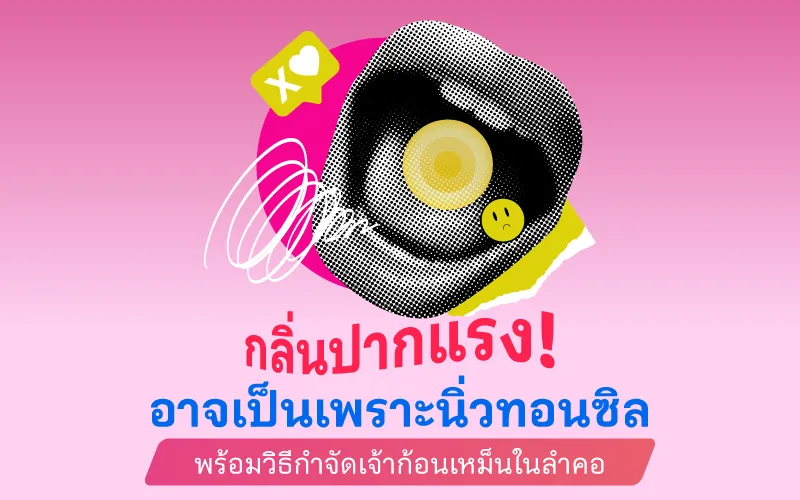  กลิ่นปากแรง! อาจเป็นเพราะนิ่วทอนซิล พร้อมวิธีกำจัดเจ้าก้อนเหม็นในลำคอ