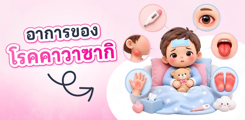 อาการโรคคาวาซากิ