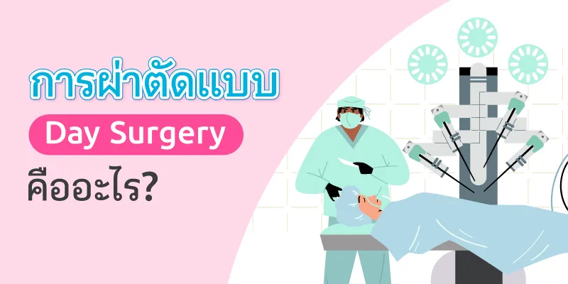 ผ่าตัดแบบ Day Surgery คืออะไร?